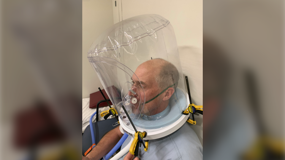 Non-invasive helmet ventilation system in development by local researchers